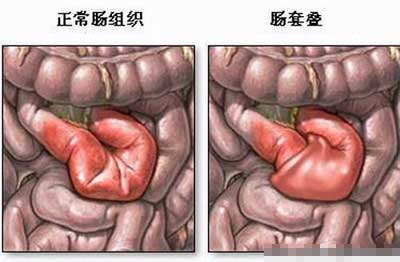 點擊浏覽下一頁