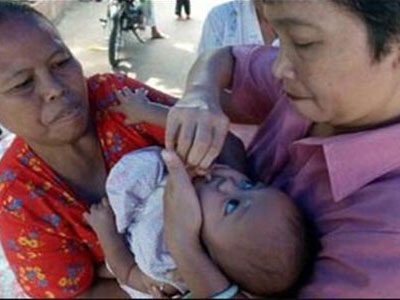 寶寶接種疫苗 反被“種”下了小兒麻痺症