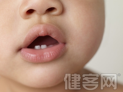 五個習慣預防寶寶齲齒 