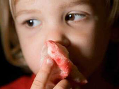 寶寶流鼻血怎麼辦 春季兒童易出鼻血