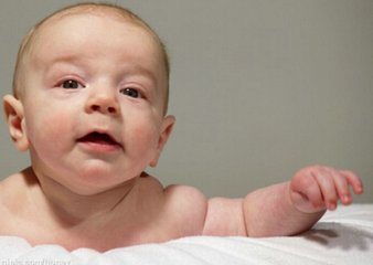 寶寶出現母乳性黃疸怎麼辦