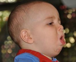 哪些寶寶止咳偏方效果好？