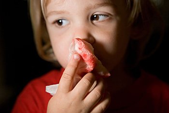 小兒鼻出血的原因及防治方法