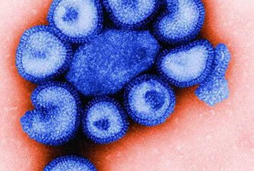 預防甲型流感應警惕肺炎