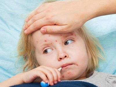嬰幼兒打麻疹疫苗要注意什麼？