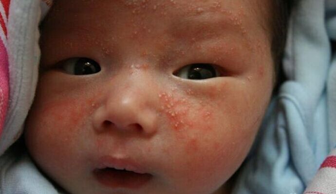 芹菜也能幫寶寶防濕疹？看看就知道