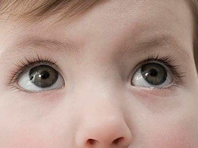 寶寶眼睛“水汪汪”或是青光眼