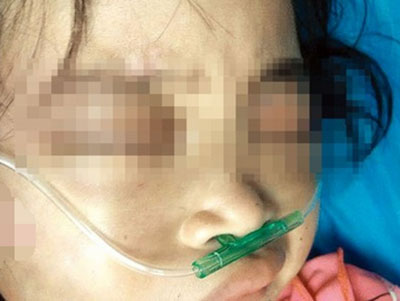 7歲女童受傷病危 竟發現下體撕裂出血！