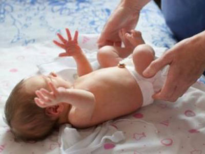 新生兒臍部流水父母要高度警惕