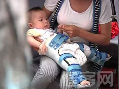 半歲嬰兒黑診所做推拿致雙腿骨折