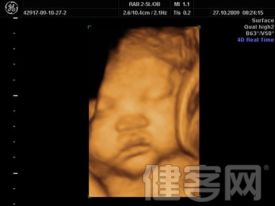四維彩超拍“萌照” 小心胎兒吃射線